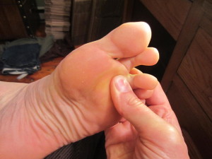 A good alternative to a Burnsville NC podiatrist (foot doctor) is to learn how to massage your feet!