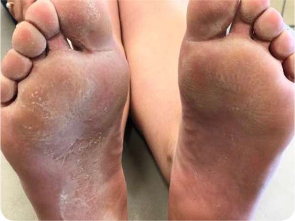 Learn why your feet are stinky, crusty and nasty!